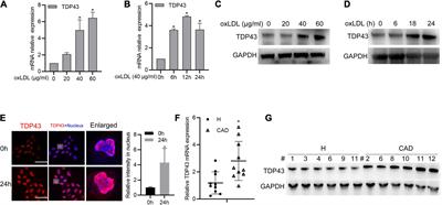 TDP43 Exacerbates Atherosclerosis Progression by Promoting Inflammation and Lipid Uptake of Macrophages